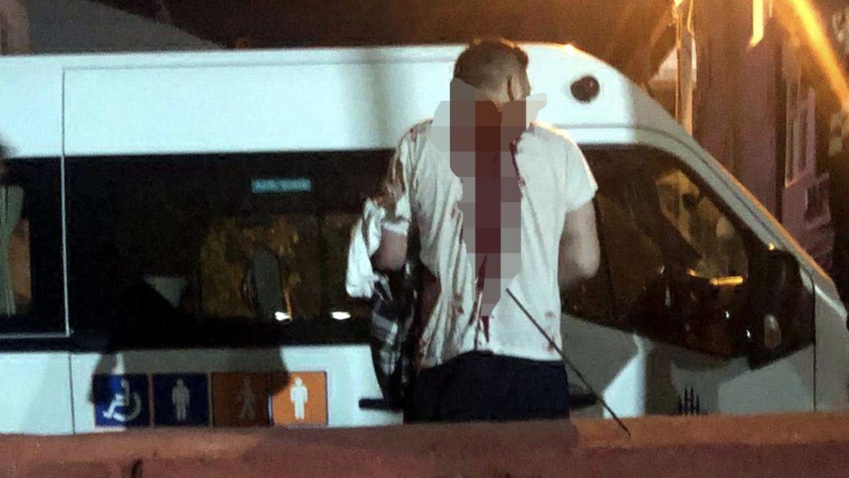 Avcılar’da ağabeyini zıpkınla yaraladı