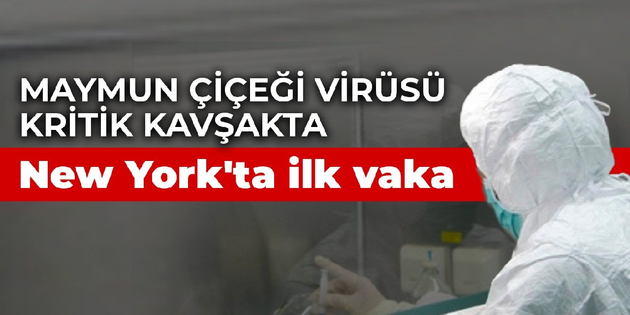 Maymun çiçeği virüsü kritik kavşakta: New York’ta ilk vaka