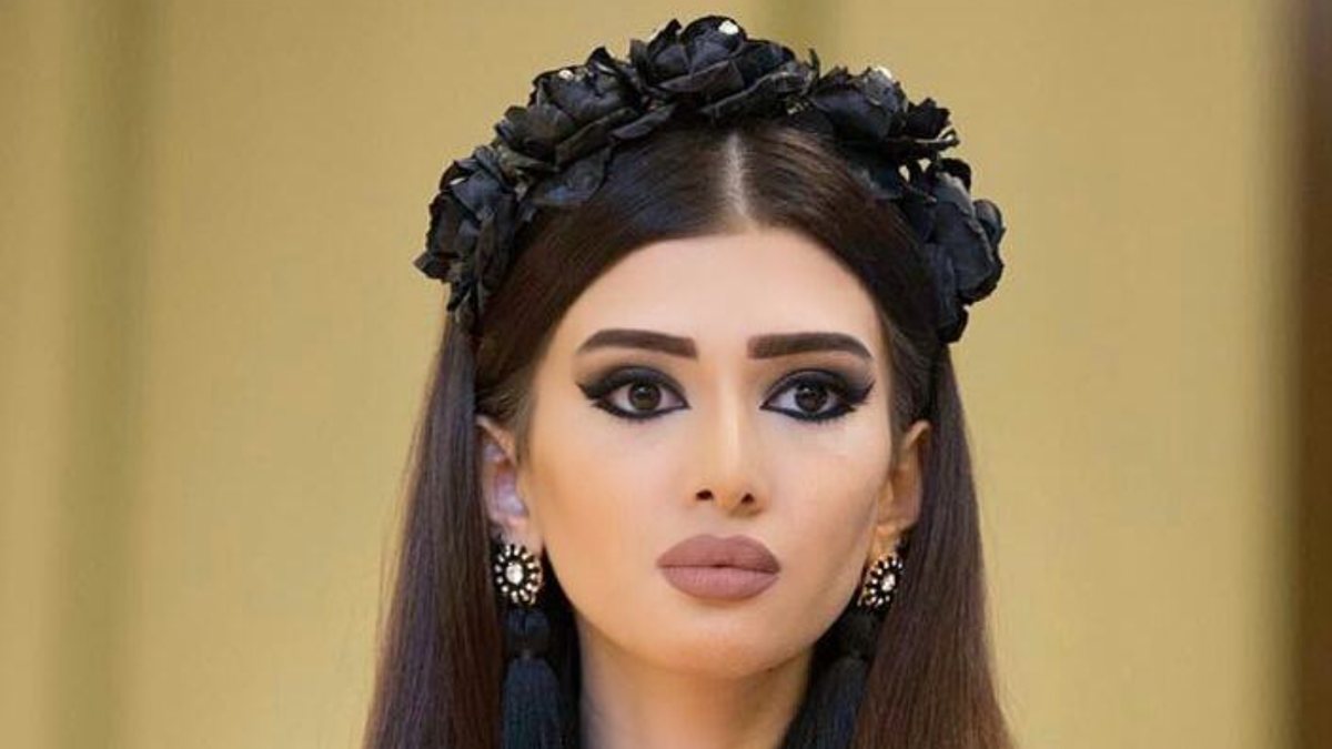 Zayıflığıyla yürürken korkutuyordu! İşte Benim Sitilim’deki Sima estetik kurbanı…