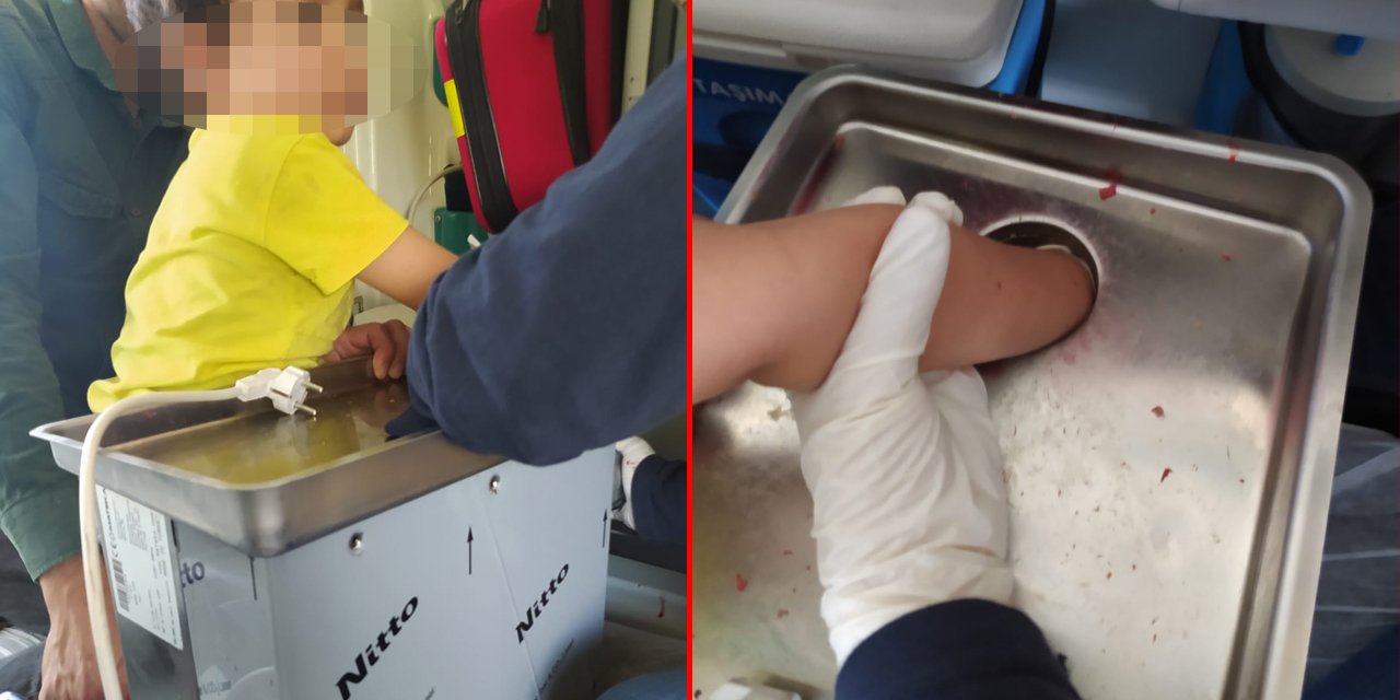 Çocuk elini kıyma makinesine kaptırdı