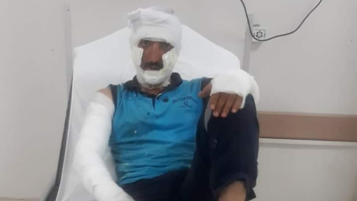 Kocaeli’de rögar kapağına kaynak yapılırken patlama yaşandı