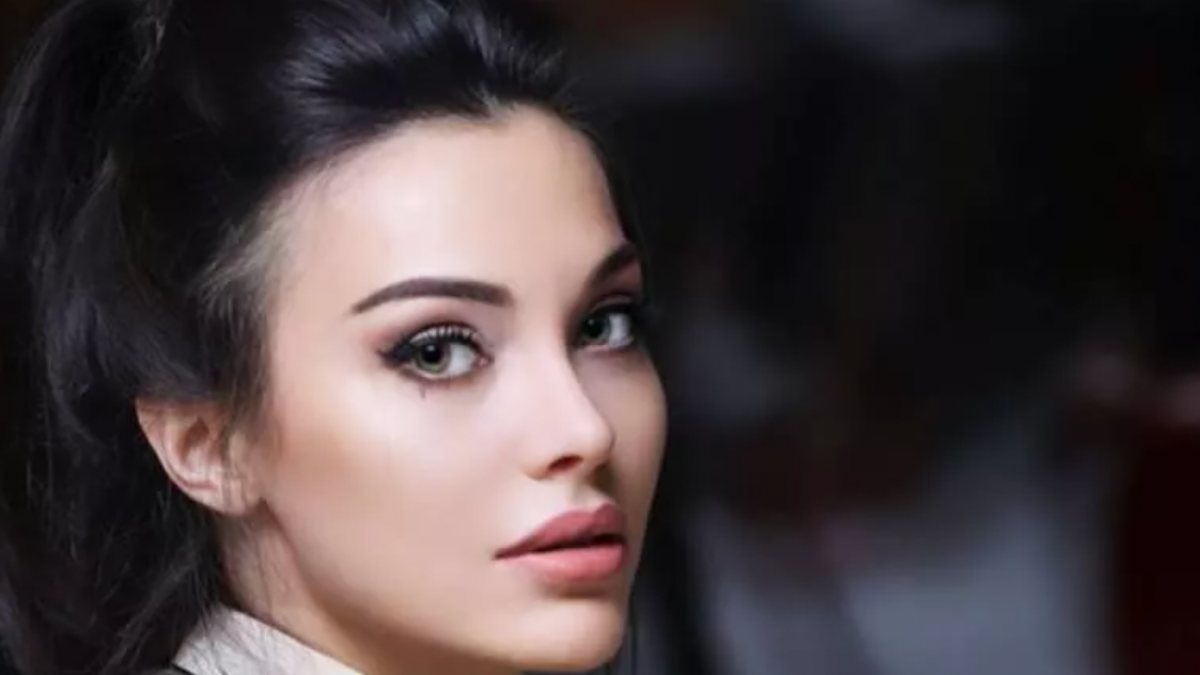 Oyuncu Tuvana Türkay’ın estetiksiz halleri şoke etti! ‘Bambaşka biri’