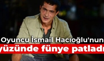 Sette kaza: Oyuncu İsmail Hacıoğlu’nun yüzünde fünye patladı