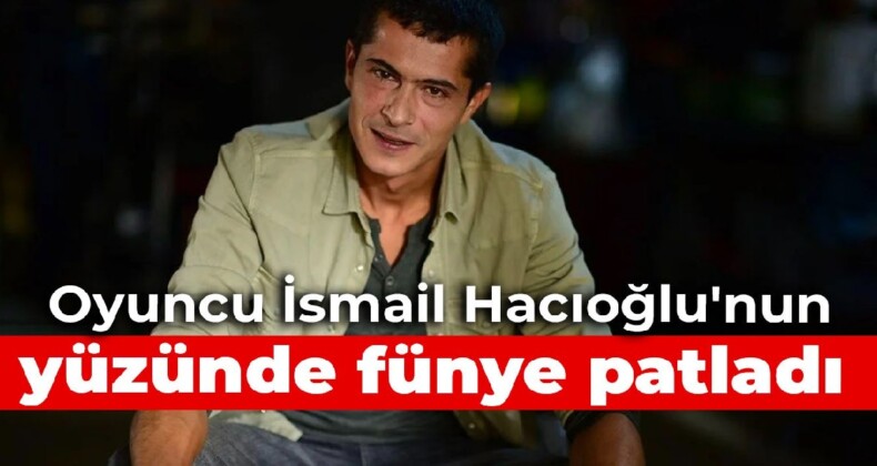 Sette kaza: Oyuncu İsmail Hacıoğlu’nun yüzünde fünye patladı