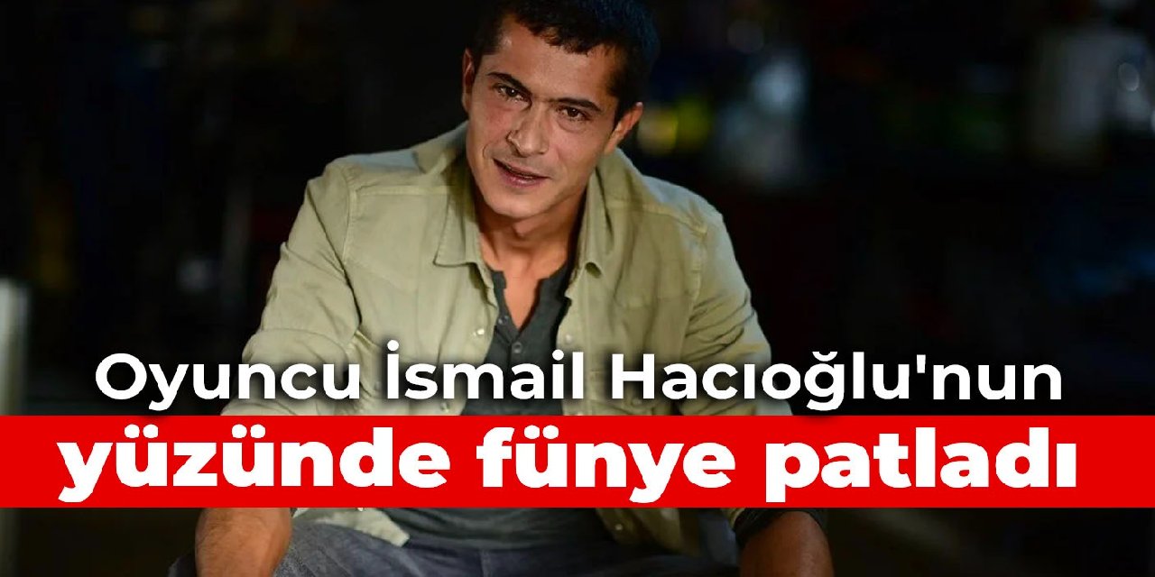 Sette kaza: Oyuncu İsmail Hacıoğlu’nun yüzünde fünye patladı