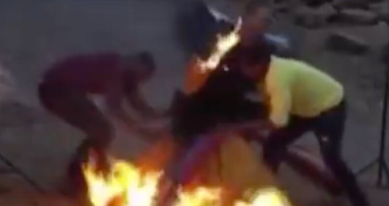Zimbabve’de fotoğraf çekimi sırasında mankenin elbisesi yandı