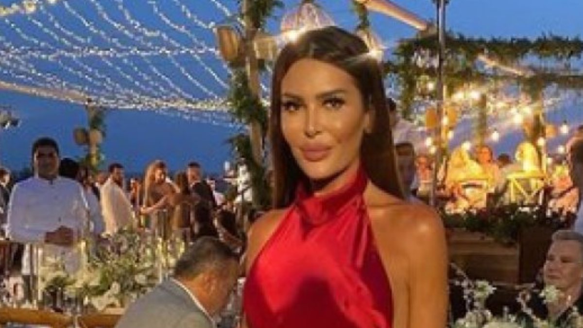 Selin Ciğerci’nin son yaptırdığı estetik tam bir fiyasko!  ‘Helin Avşar sandım’