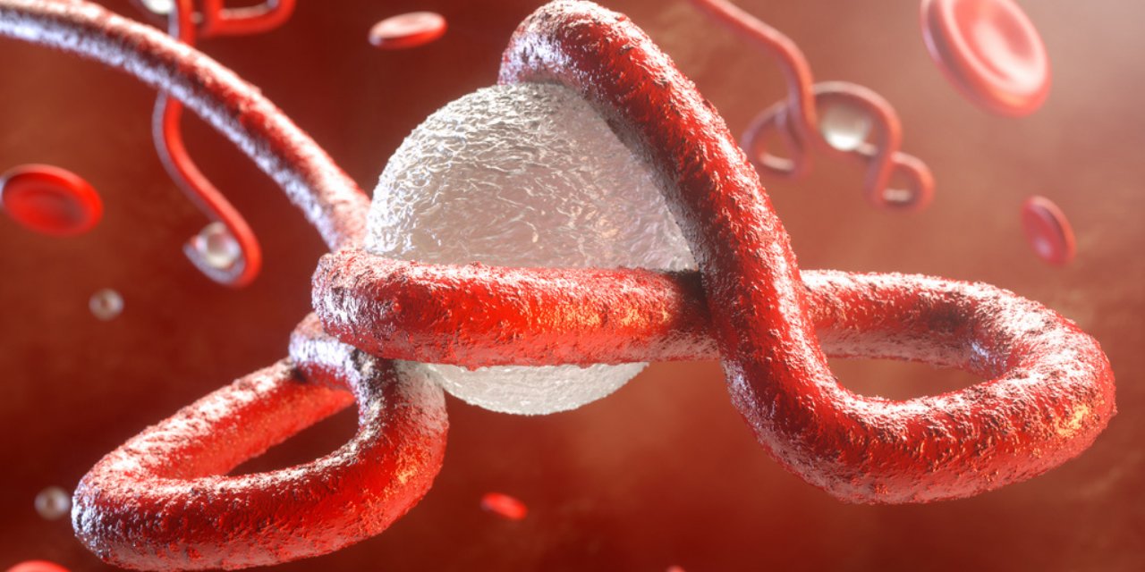 Uganda’da Ebola alarmı