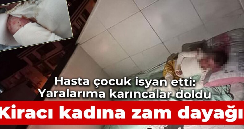 Zammı vermek istemeyen kiracı kadına zam dayağı