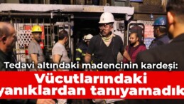 Tedavi altındaki madencinin kardeşi: Vücutlarındaki yanıklardan tanıyamadık