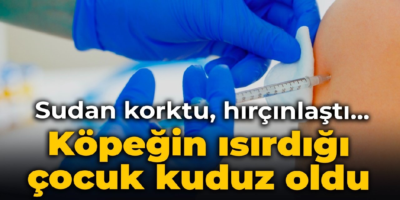 Köpeğin ısırdığı çocuk kuduz oldu: Sudan korktu, hırçınlaştı…
