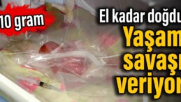 El kadar doğdu: Yaşam savaşı veriyor