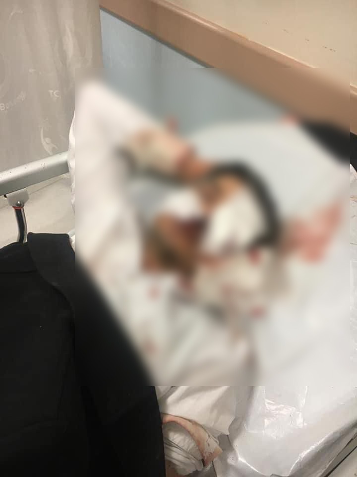 Sivas Ziraat Odası genel sekreterine saldırı