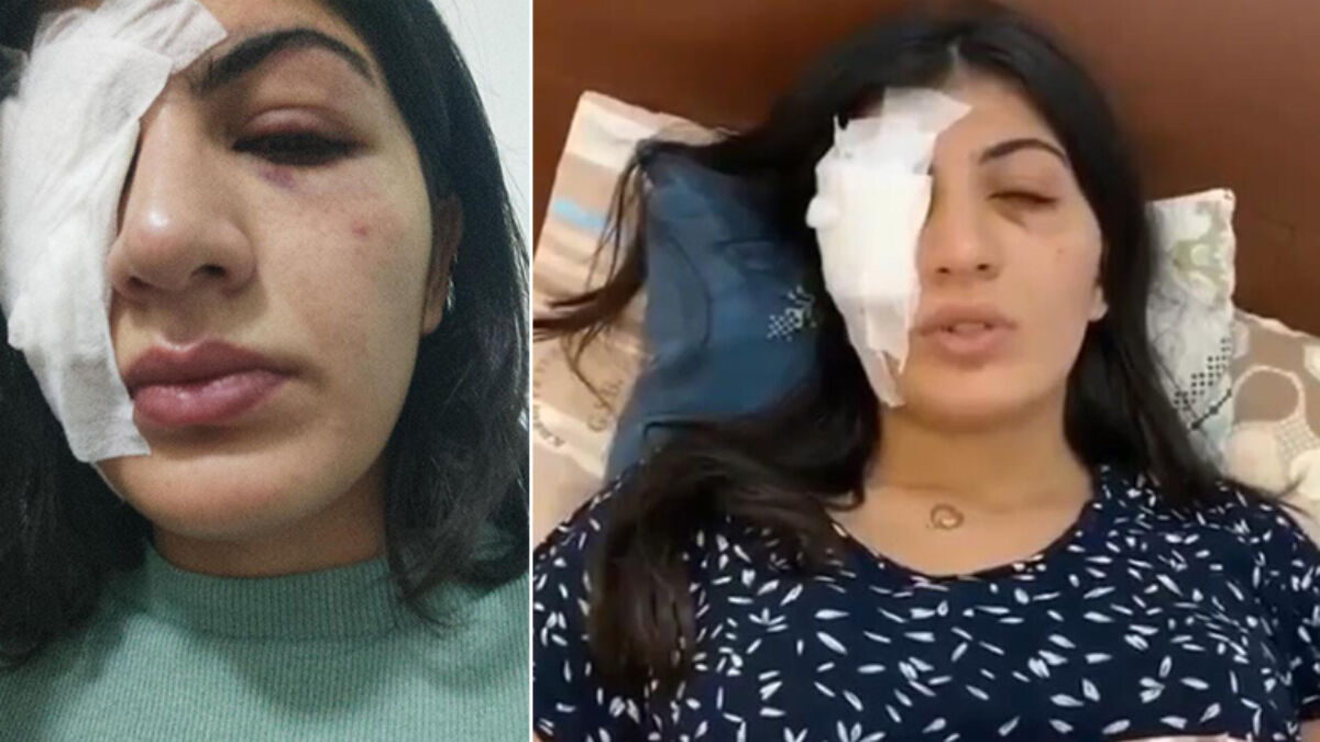 Mersin’de genç kıza içi su dolu balon atan şahıslar tahliye edildi