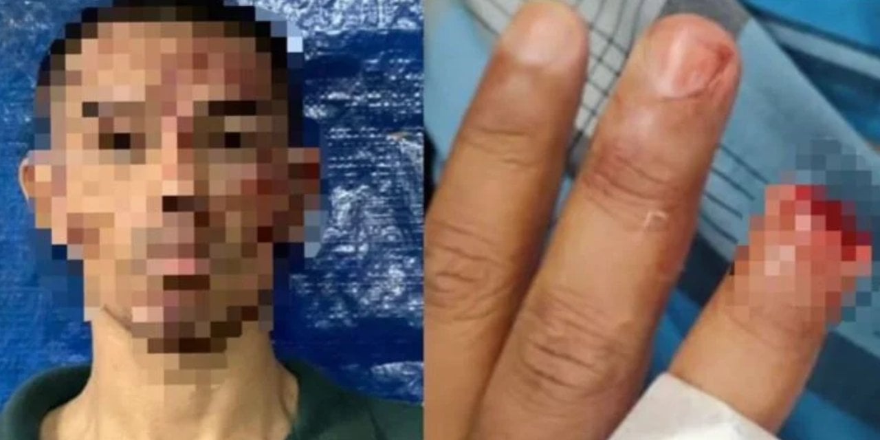 Asit atmakla tehdit ettiği polisin parmağını ısırarak kopardı