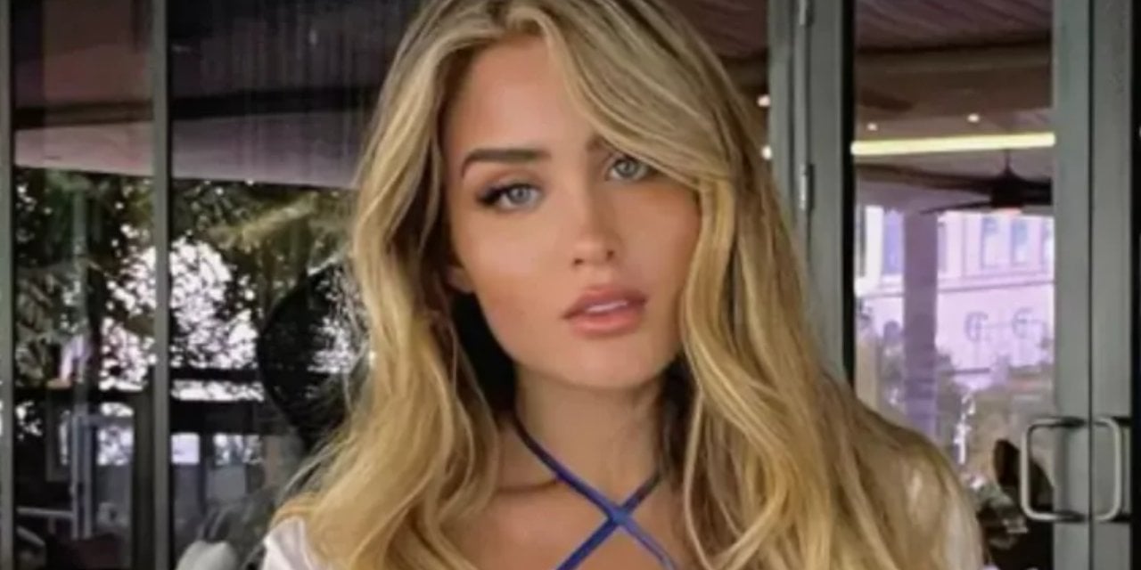 Estetiğin gücüyle bambaşka biri oldu! “O kadar çirkindim ki…”