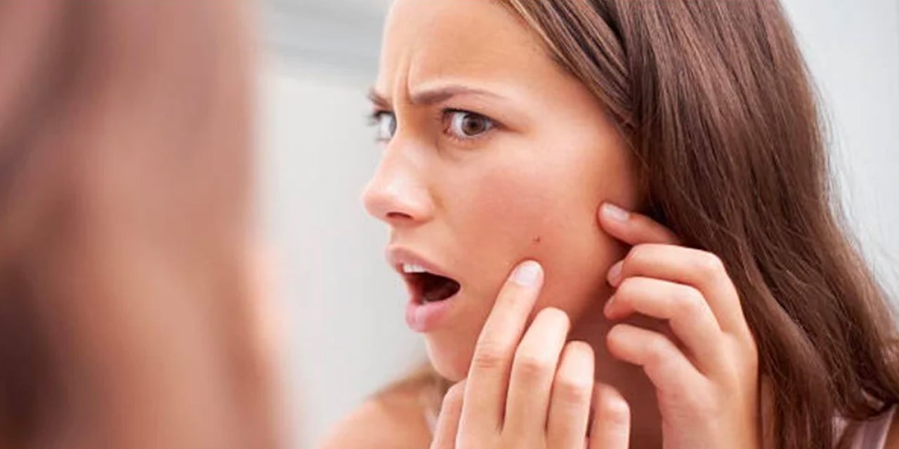 Bir türlü kurtulamadığınız sivilcelerinizin nedeni, o besin maddesi olabilir!