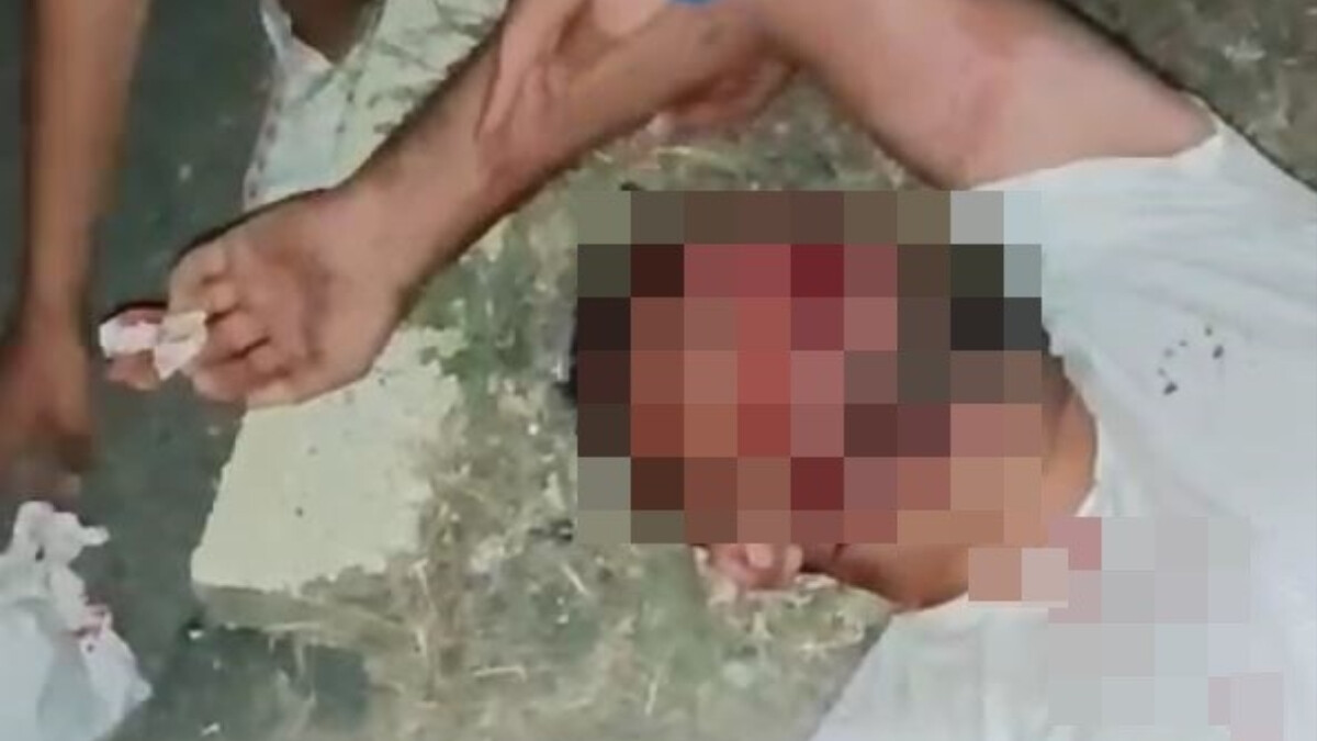 Antalya’da kazadan kurtulup telefonunu ararken çukura düştü