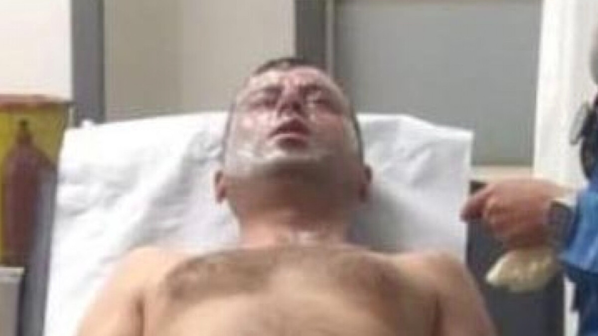 Kocaeli’de lavabo açıcı yüzüne patladı: Hastaneye kaldırıldı