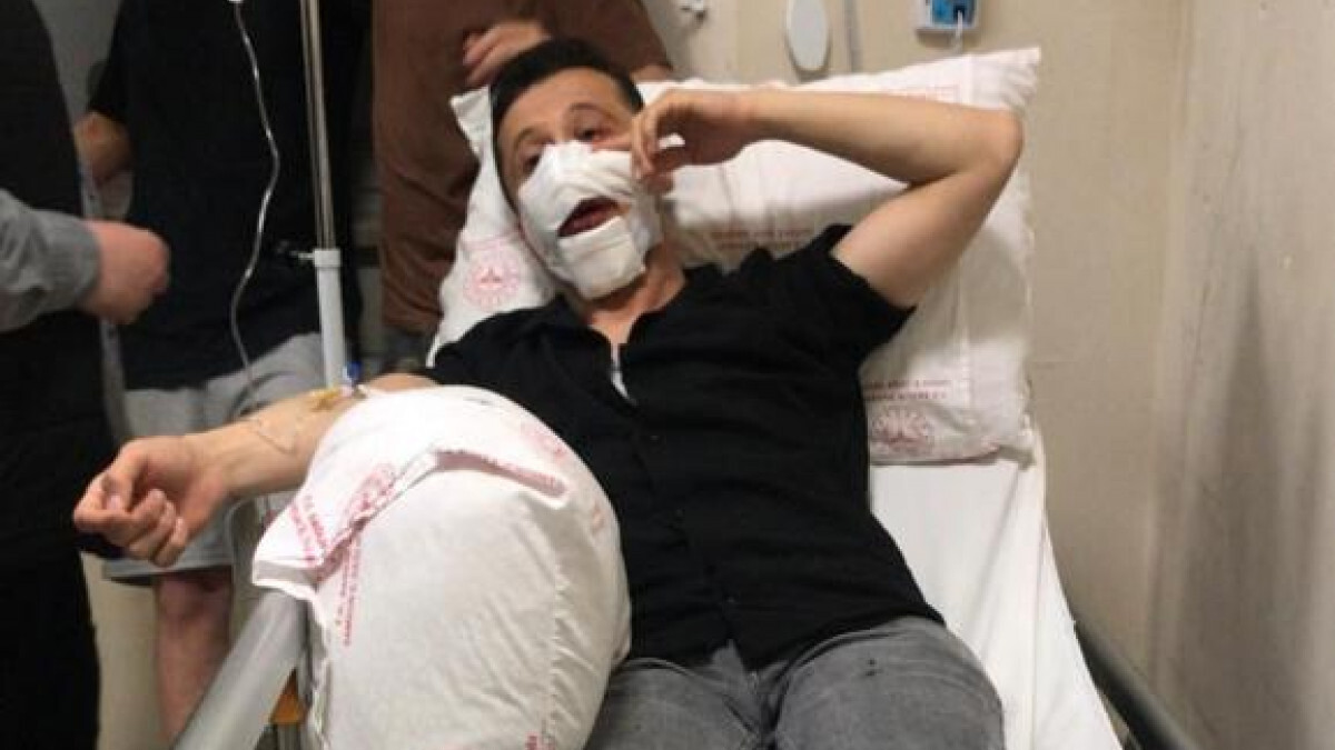 Samsun’da maganda kurşunu ile biri çocuk 3 kişi yaralandı