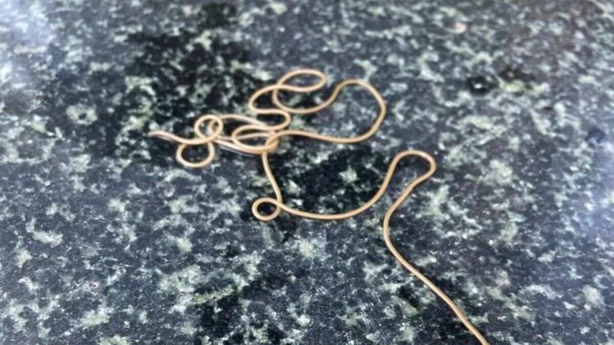 Artvin’de köy çeşmesinde bulunan canlının solucan olduğu ortaya çıktı