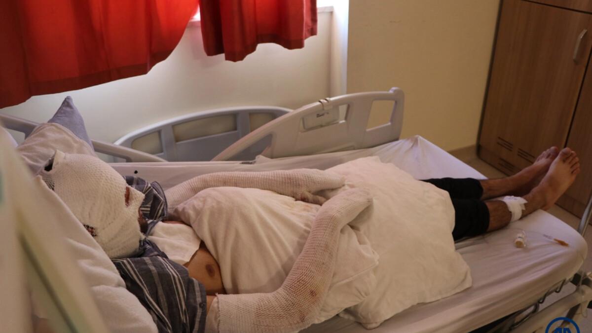 Erzurum’da çakmak doldururken hastanelik oldular