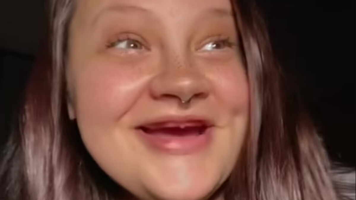 Gülüşünü düzeltmek için 21 dişini çektiren Amerikalı Lacey: Takma dişlerimi fotoğraflarda kullanıyorum