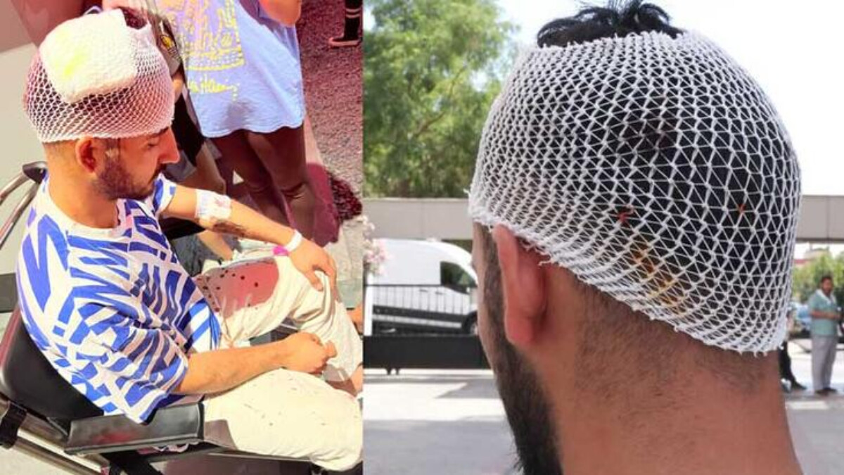 İstanbul Bahçelievler’de korkunç olay: Kafasına tüp düştü