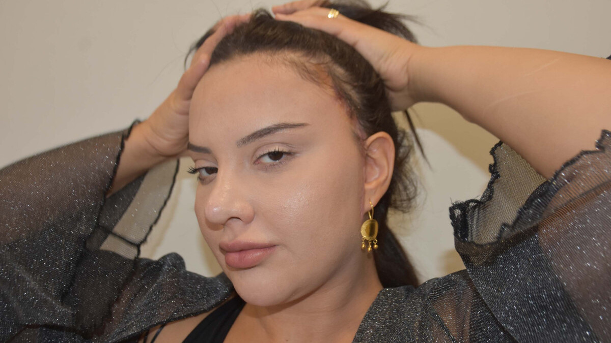 İzmir’de badem göz ameliyatı olan kadının yüzünde kalıcı izler oluştu