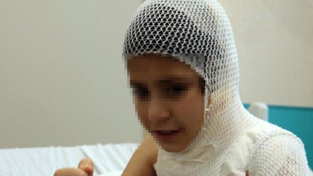 Muş’ta sosyal medyada gördüğü videoyu denedi: Canından oluyordu