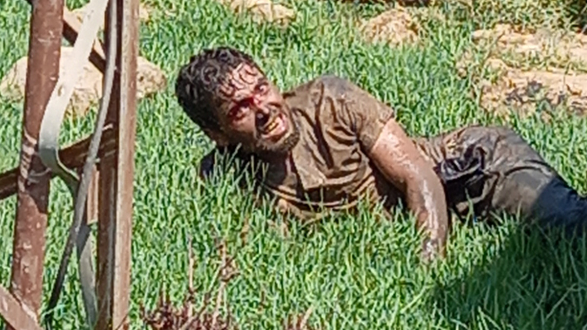 Şanlıurfa’da köpeğin ısırması sonrası kuduz olan Suriyeli hayatını kaybetti