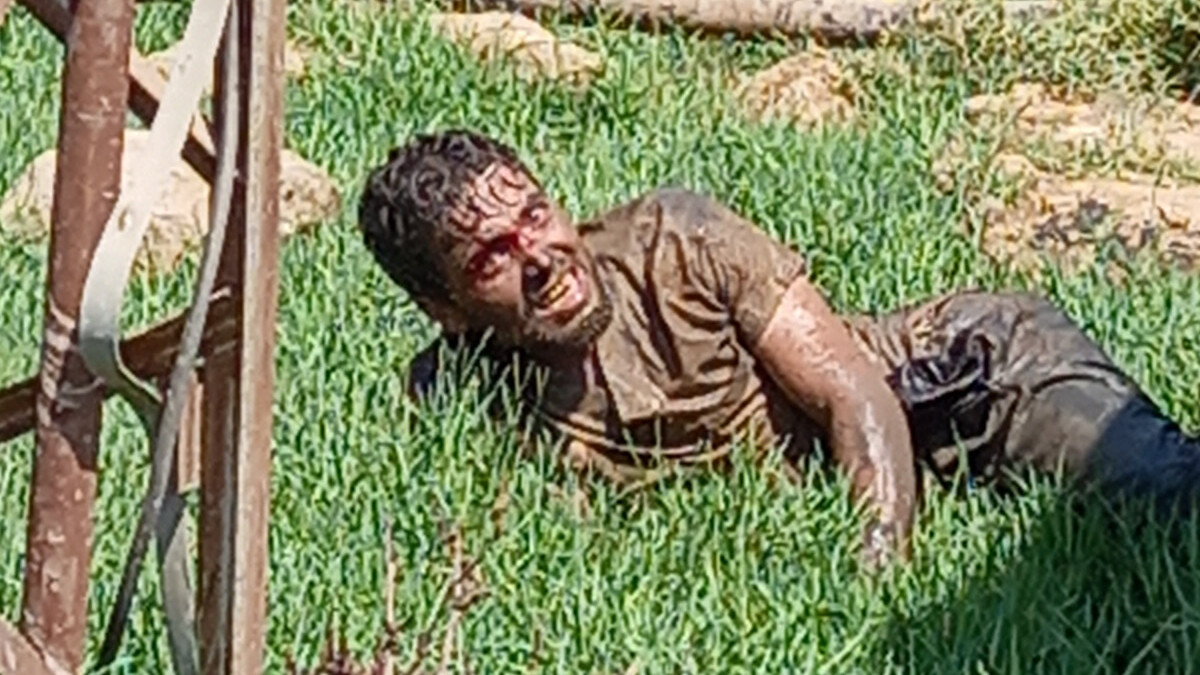 Şanlıurfa’da kuduz teşhisi konulan bir kişi hastaneden kaçtı