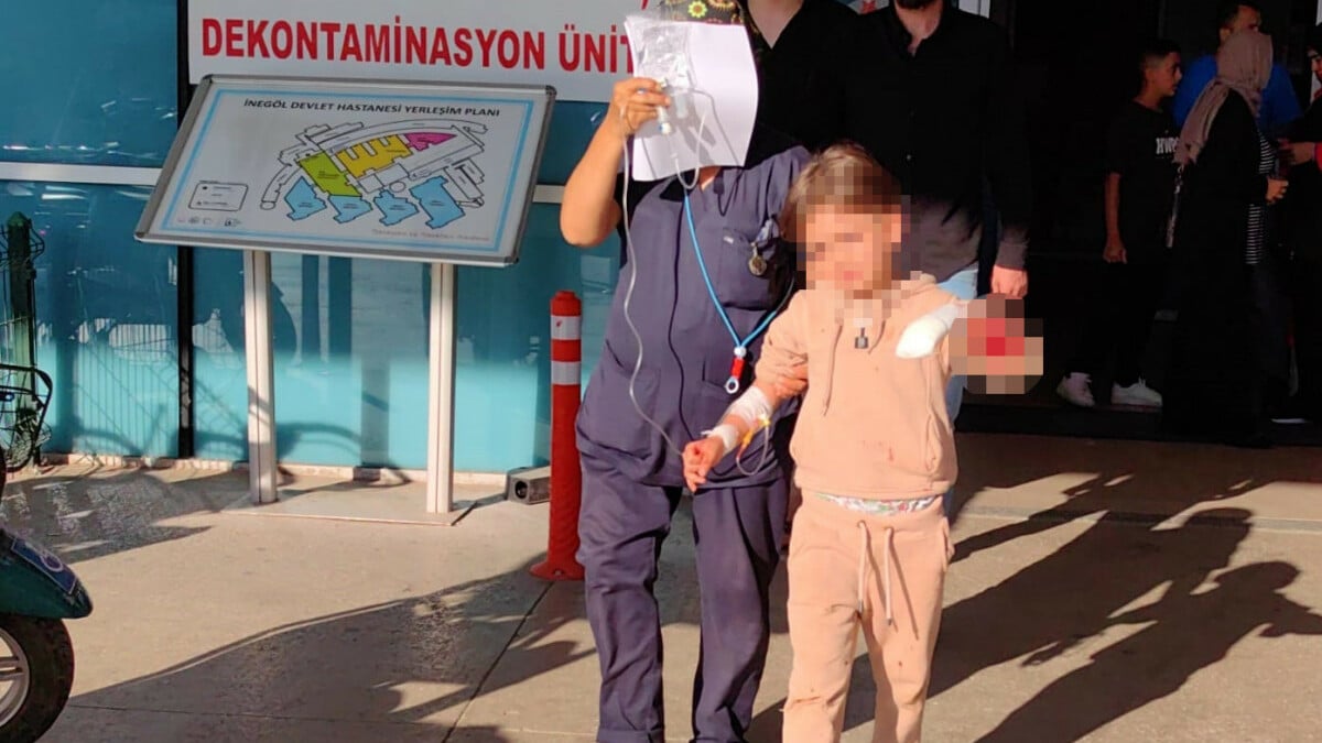 Bursa’da oyun sırasında 6 yaşındaki çocuğun 3 parmağı koptu
