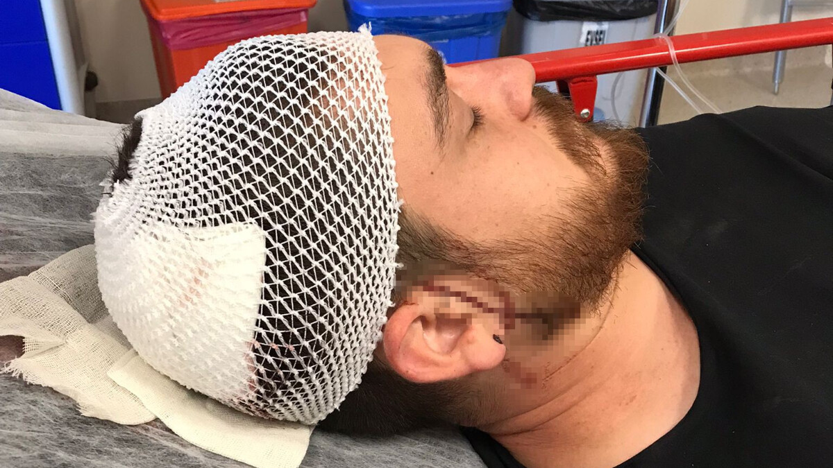 Elazığ’da trafik kavgası: Sürücünün kafasına çekiçle vurdu