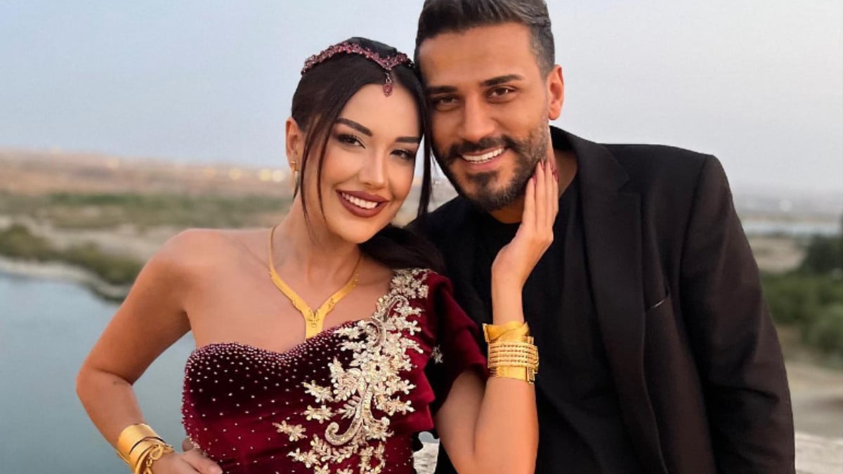 Dilan Polat’ın 2015 yılındaki arşivi ortaya çıktı: Estetikle kendini baştan yaratmış! Gören tanıyamadı