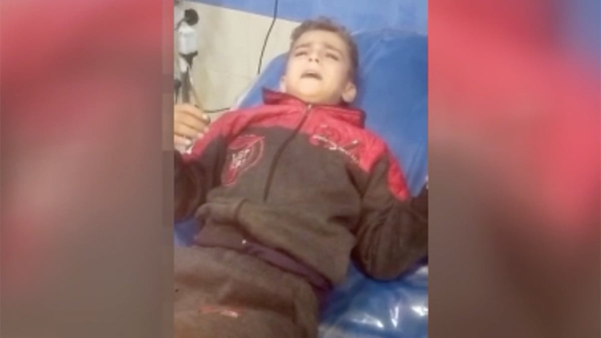 Gazze’de anestezisiz ameliyat edilen çocuk Kuran’ı Kerim okudu