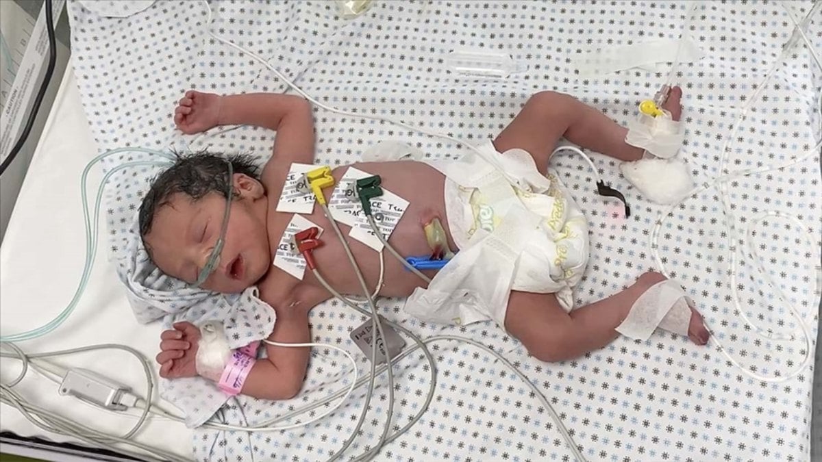 Gazze’de İsrail’in saldırılarında ölen annenin karnındaki bebeği kurtarıldı