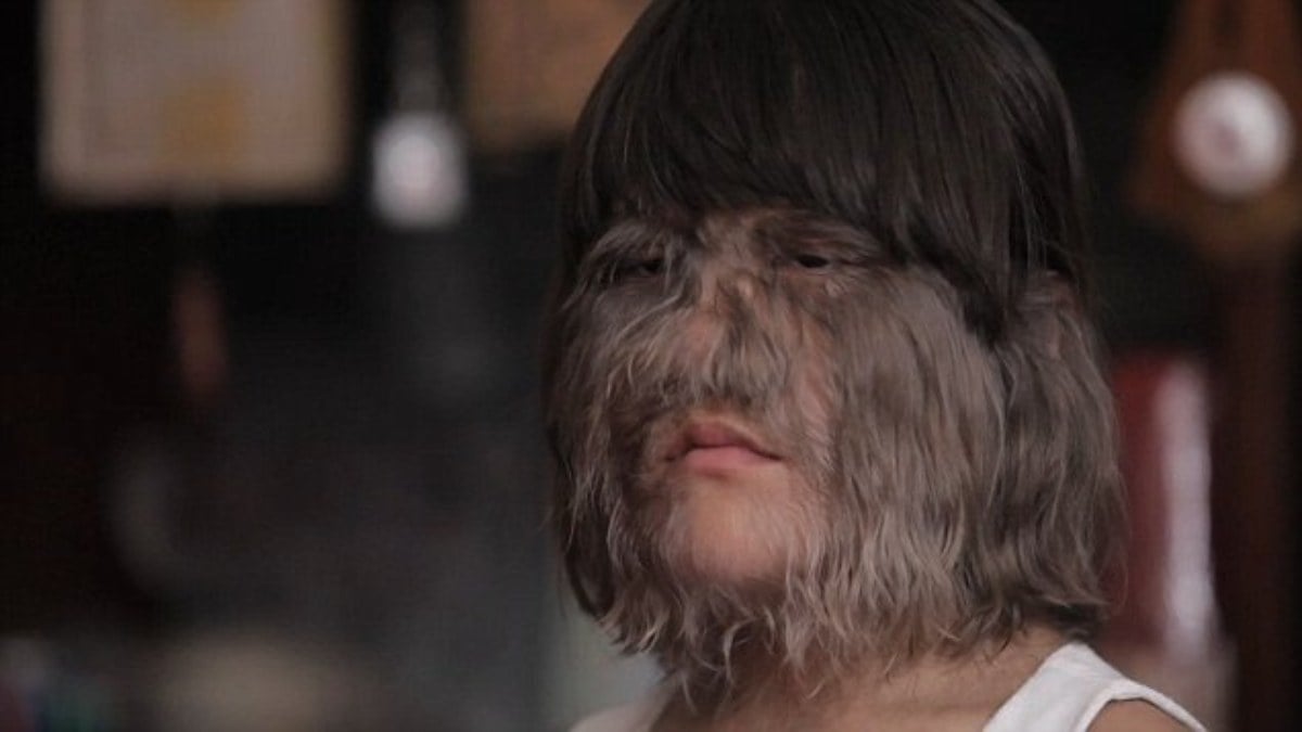 Dünyanın en tüylü kızıydı! Son hali dumur etti…”Epilasyon çıktı, kurtluk bozuldu”