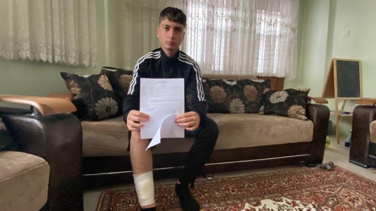 Bir sokak köpeği saldırısı daha! Karabük’te 14 yaşındaki çocuk yaralandı