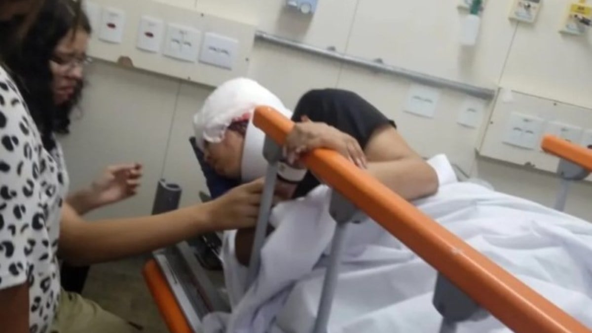 Brezilya’da karting kazası: Genç kızın kafa derisi koptu