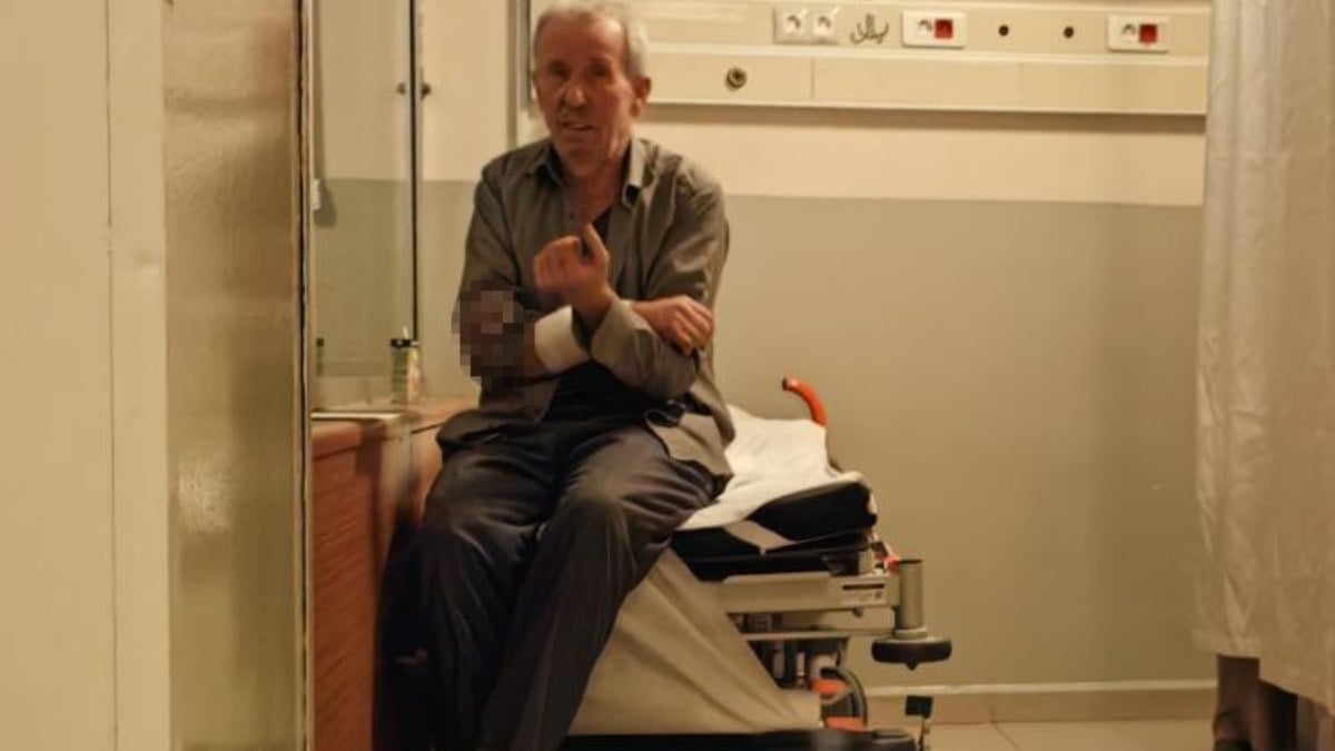 Bursa’da beslediği köpek sağ kolunu parçaladı!