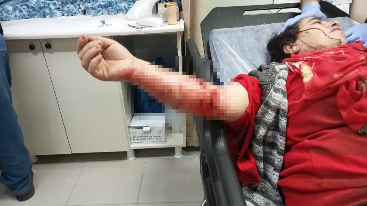 Hatay’da yasak ırklı köpek saldırısı! Kadın hastaneye kaldırıldı