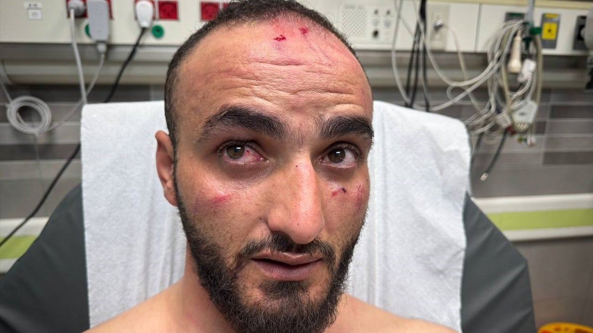 Tüfekle başına vurdular! İsrail askerinin AA muhabirini darbettiği anlar