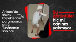 Ankara’da köpeklerin saldırısı sonucu ağır yaralanan Tunahan’ın hastane görüntüleri