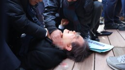 Bıçaklı saldırıya uğrayan Güney Kore ana muhalefet lideri ameliyat edildi