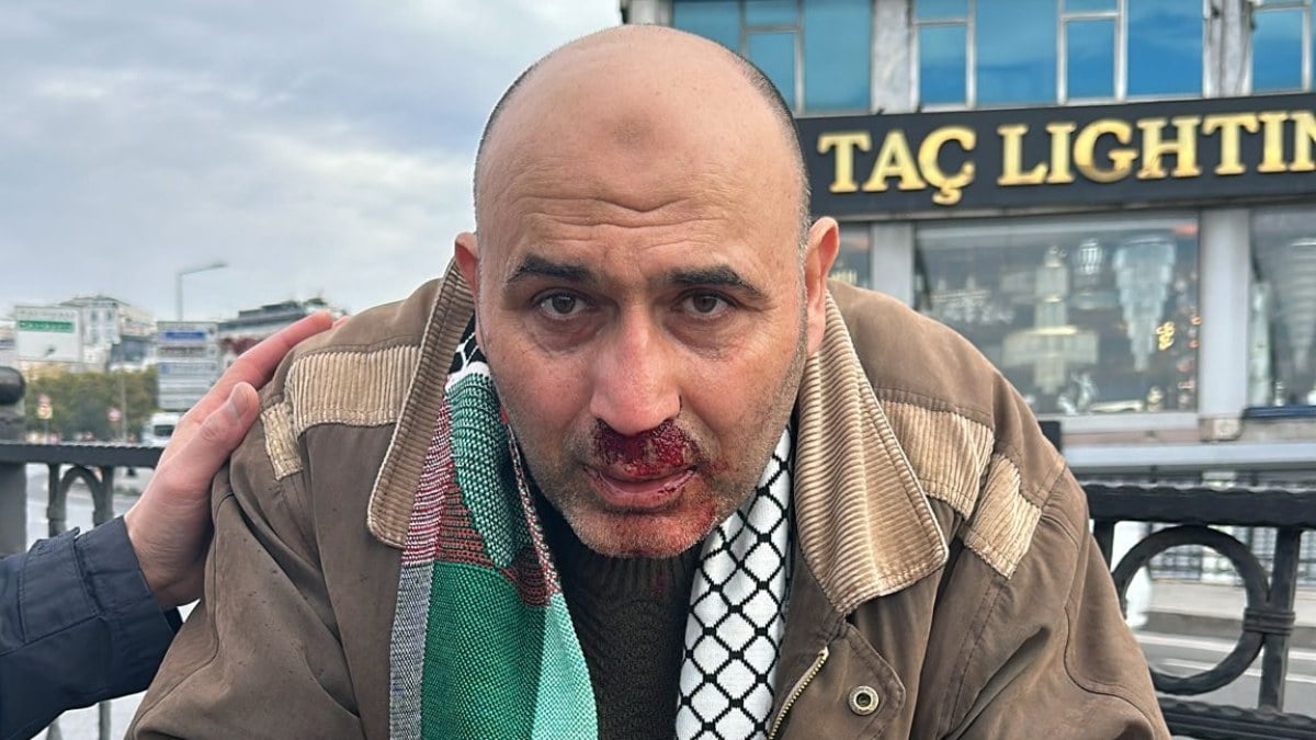 Filistin’e destek yürüyüşünden dönen vatandaşa yumruklu saldırı