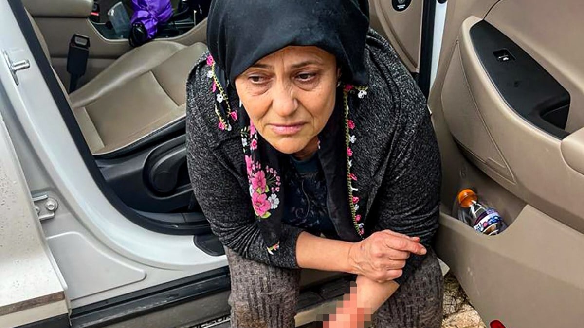 Saldırgan köpek dehşeti! Antalya’da yumurta toplayan kadına doberman saldırdı…