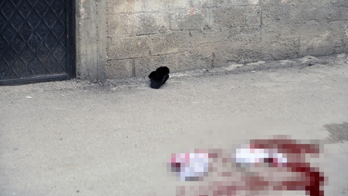 Adana’da tartıştığı kızını bıçaklayarak ağır yaraladı: Hayati tehlikesi bulunuyor