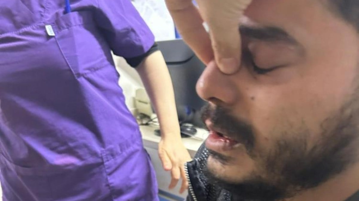 Gaziantep’te doktorun burnu kırıldı! “Ne kimliği, sen muayeneni yap…”