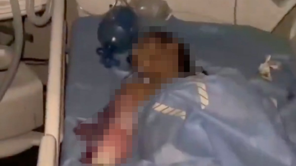 Gazze’de hastanede elektrik kesintisi 1 çocuğun ölümüne neden oldu